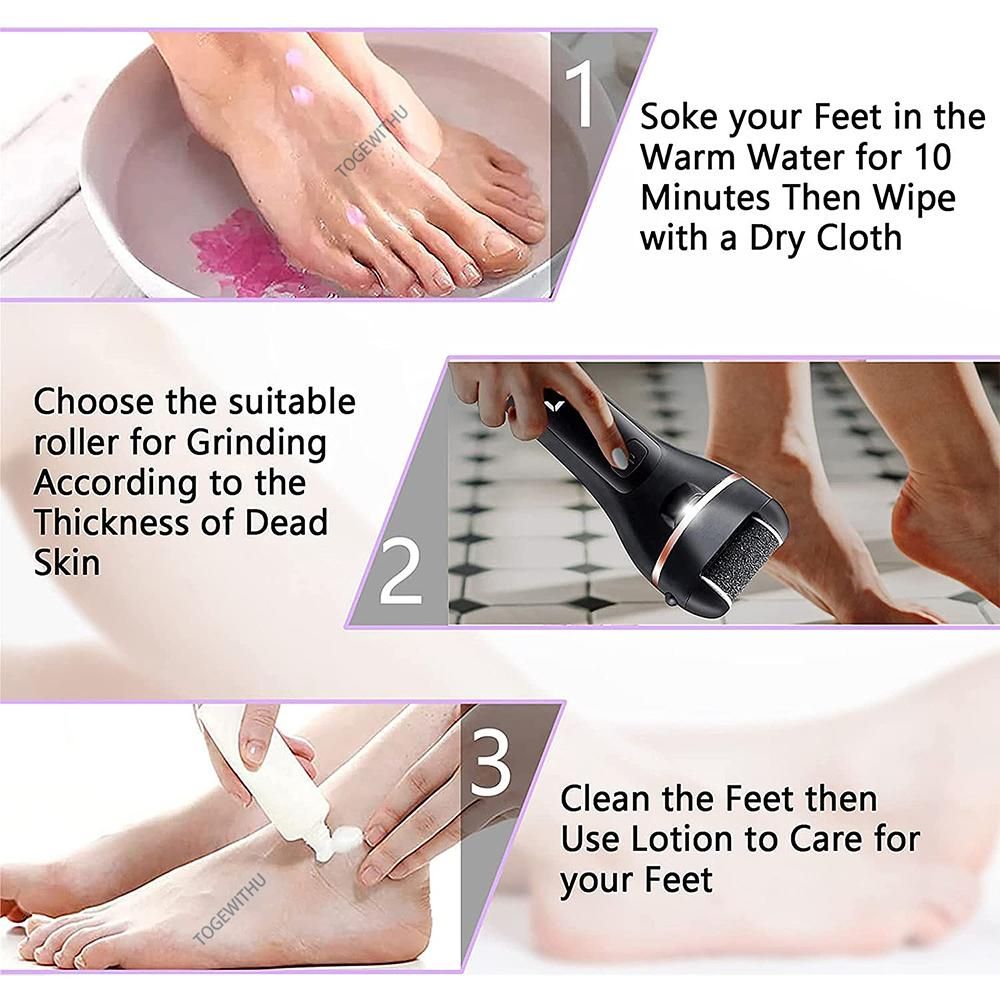 Electric Callus Remover for Feet, Rechargeable Foot Scrubber Foot File Hard Skin Remover Pedicure Tools Set for Feet Waterproof Pedicure kit for Cracked Heels and Dead Skin with LED Light and 3 Roller Heads