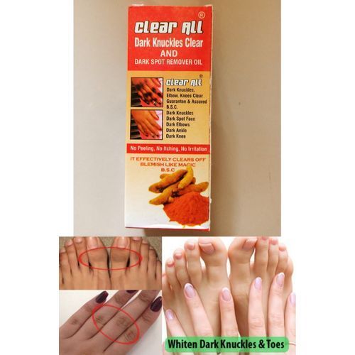 Clear All Dark Knuckles Clear And Dark Spot Remover Oil