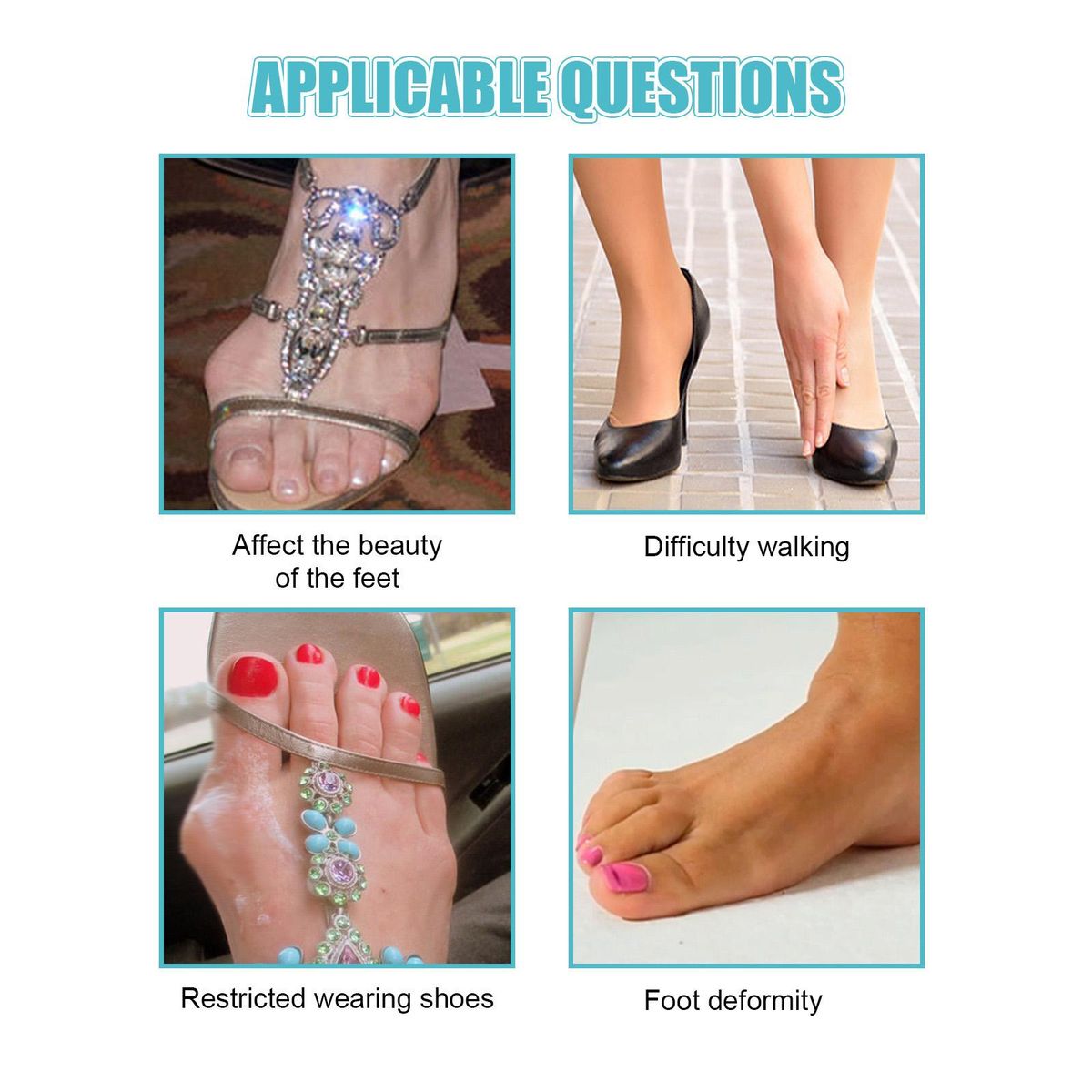 South Moon 8PCS Bunion Patch Relief Bunion Swelling Pain Patch Correction Foot Care Patch