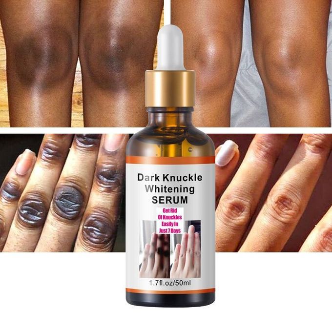 Effective Dark Knuckle Serum - Remove Dark Knuckle In 7 Days
