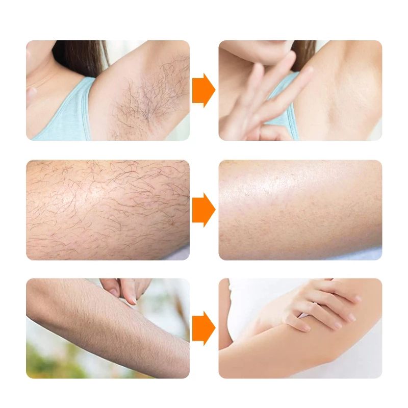Effective Hair Removal Cream Body Painless Depilatory Cream